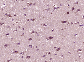 Bax beta Rabbit Polyclonal Antibody