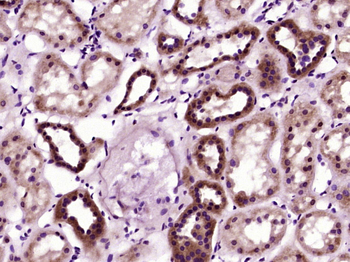 Bax beta Rabbit Polyclonal Antibody