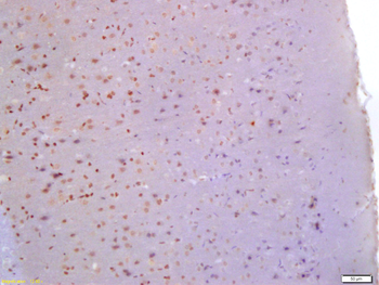 Glutamine PRPP amidotransferase Rabbit Polyclonal Antibody