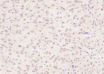MST3/STK3 Rabbit Polyclonal Antibody