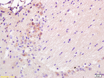 BBC3/PUMA Rabbit Polyclonal Antibody