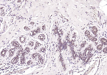 Retinoic acid induced 17 Rabbit Polyclonal Antibody