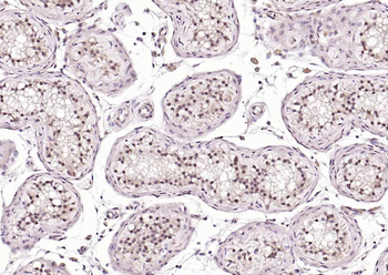 Retinoic acid induced 17 Rabbit Polyclonal Antibody
