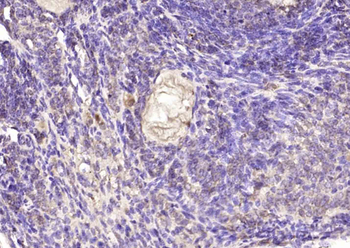 Retinoic acid induced 17 Rabbit Polyclonal Antibody