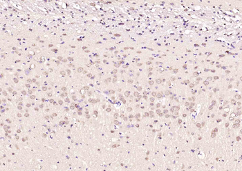 Retinoic acid induced 17 Rabbit Polyclonal Antibody