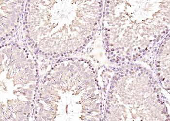 Retinoic acid induced 17 Rabbit Polyclonal Antibody