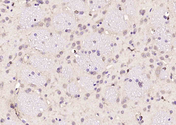 SMC5 Rabbit Polyclonal Antibody