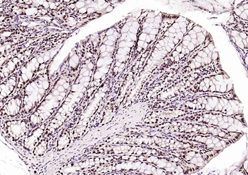 BRD7 Rabbit Polyclonal Antibody