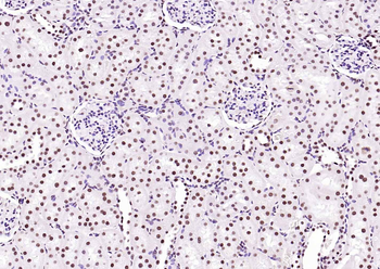 BRD7 Rabbit Polyclonal Antibody