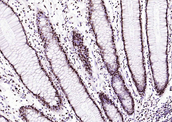 BRD7 Rabbit Polyclonal Antibody
