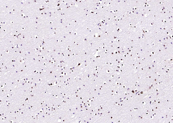 BRD7 Rabbit Polyclonal Antibody