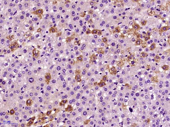 BMP9 Rabbit Polyclonal Antibody