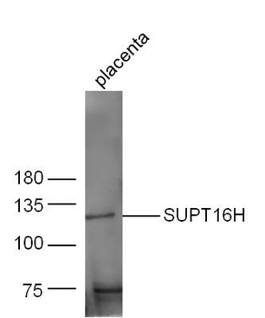 SUPT16H Rabbit Polyclonal Antibody