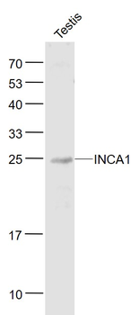 INCA1 Rabbit Polyclonal Antibody