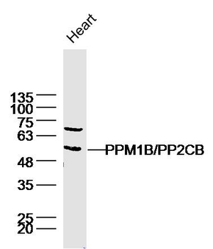 PPM1B Rabbit Polyclonal Antibody