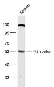 IKB epsilon Rabbit Polyclonal Antibody