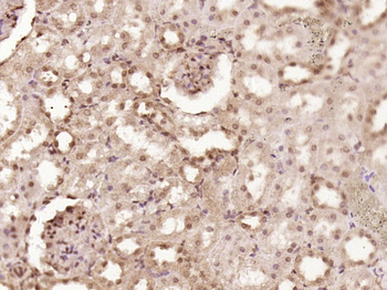 CDKN2B/p15 INK4b Rabbit Polyclonal Antibody