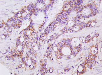 LGALS3BP Rabbit Polyclonal Antibody