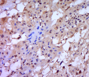 MMP-2 Rabbit Polyclonal Antibody