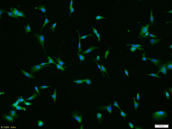 MMP-2 Rabbit Polyclonal Antibody
