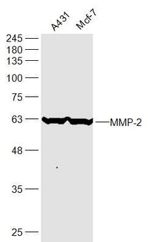 MMP-2 antibody