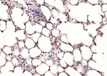 PPP2R3 Rabbit Polyclonal Antibody