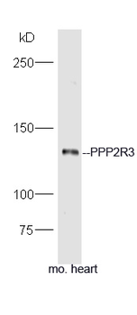 PPP2R3 Rabbit Polyclonal Antibody
