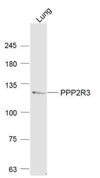 PPP2R3 Rabbit Polyclonal Antibody