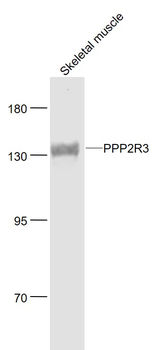 PPP2R3 Rabbit Polyclonal Antibody