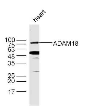 ADAM18 Rabbit Polyclonal Antibody