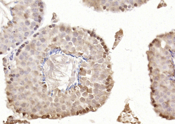 CASC5 Rabbit Polyclonal Antibody