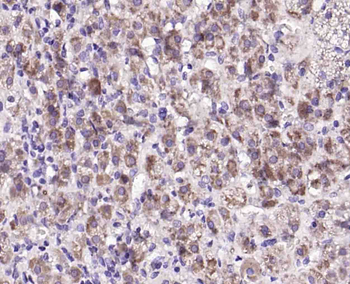 DAB2 Rabbit Polyclonal Antibody