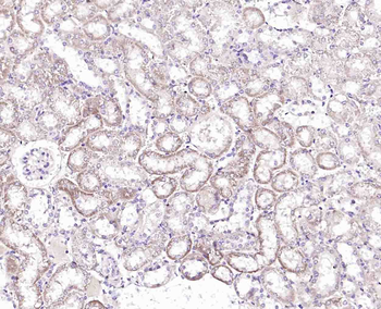 DAB2 Rabbit Polyclonal Antibody