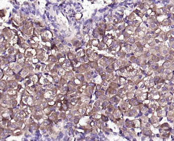 DAB2 Rabbit Polyclonal Antibody