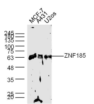 ZNF185 Rabbit Polyclonal Antibody