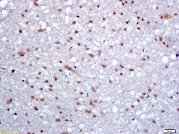 KDM5B Rabbit Polyclonal Antibody