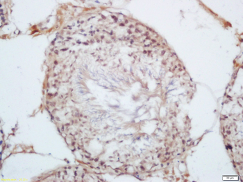KDM5B Rabbit Polyclonal Antibody