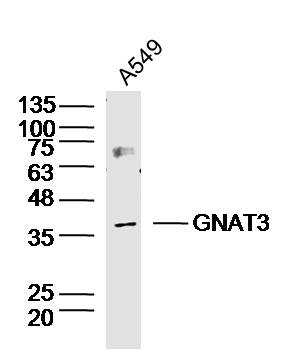 GNAT3 Rabbit Polyclonal Antibody