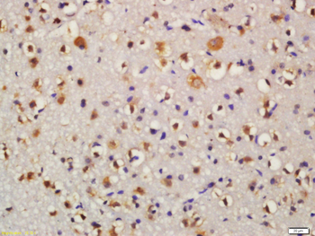 Bid Rabbit Polyclonal Antibody
