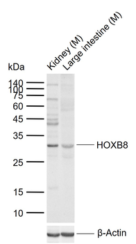 HOXB8 Rabbit Polyclonal Antibody