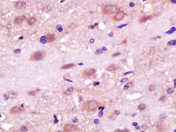 RLBP1L1 Rabbit Polyclonal Antibody