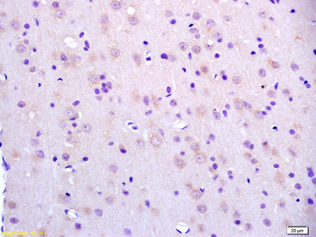BCAT2 Rabbit Polyclonal Antibody