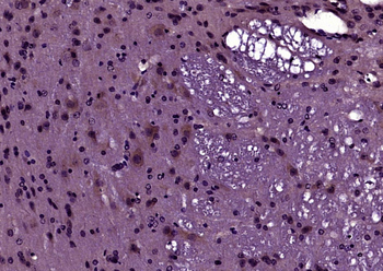 PPT1 Rabbit Polyclonal Antibody