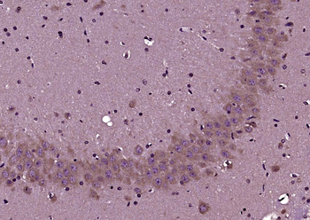 PPT1 Rabbit Polyclonal Antibody