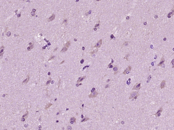 MAOA Rabbit Polyclonal Antibody