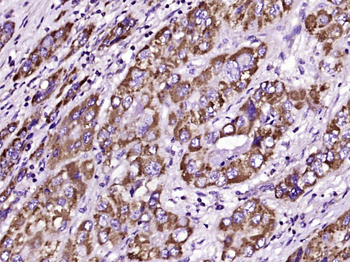 MAOA Rabbit Polyclonal Antibody