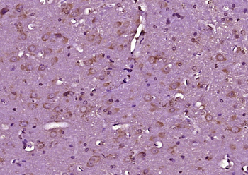 LGI1 Rabbit Polyclonal Antibody