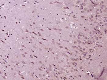 5HT3B receptor Rabbit Polyclonal Antibody