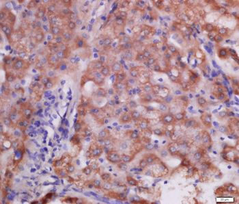 Ubiquitously expressed transcript Rabbit Polyclonal Antibody