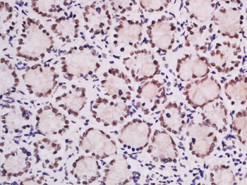 Ubiquitously expressed transcript Rabbit Polyclonal Antibody